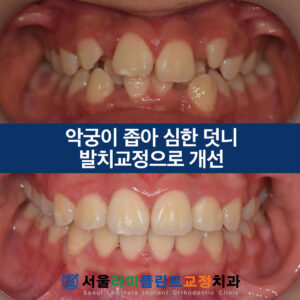 동탄역교정치과