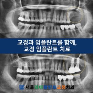 서울라미 증례 1