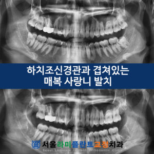동탄역치과