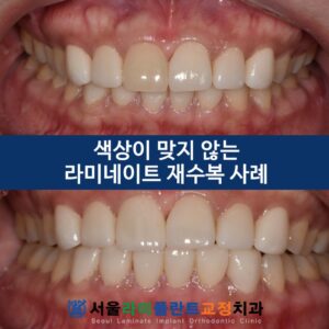 동탄역치과
