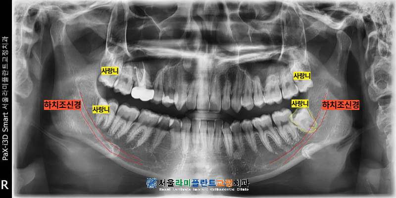 동탄역치과