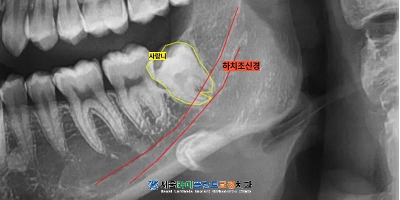 동탄역치과