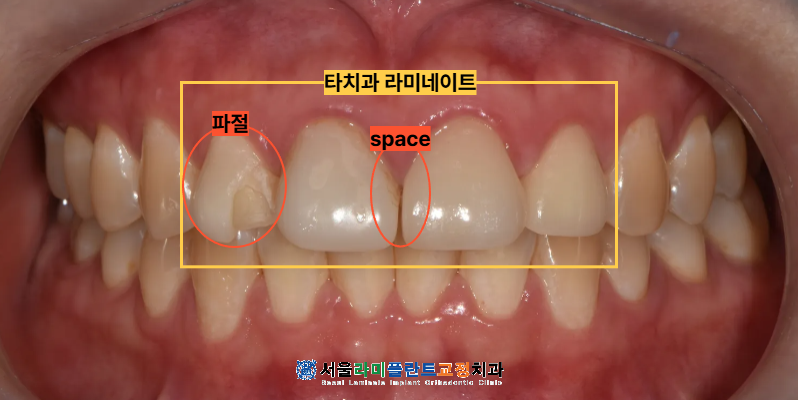 동탄역치과