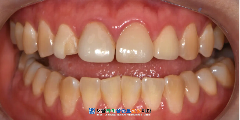 동탄역치과