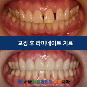 260527 서울라미 증례 표지
