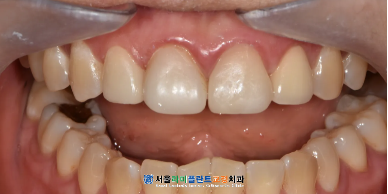 동탄역치과
