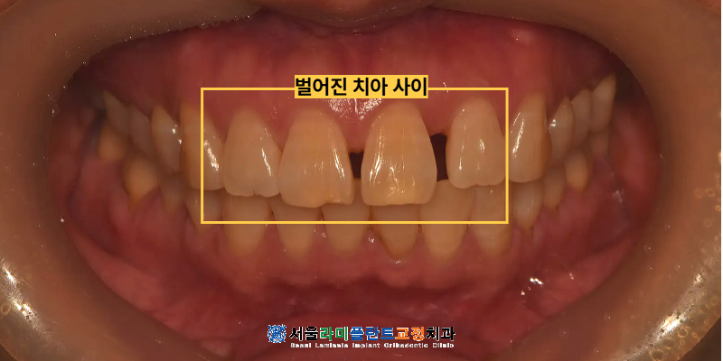 동탄라미네이트