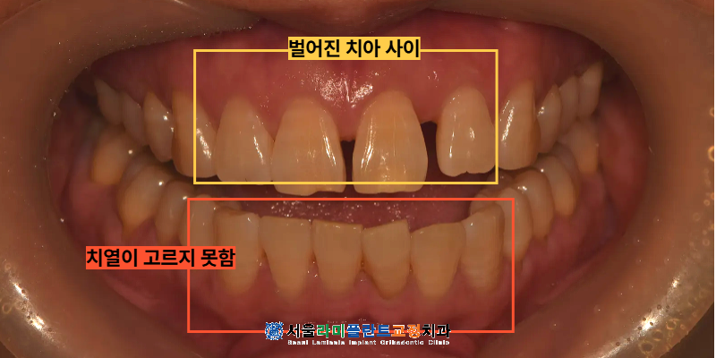 동탄라미네이트