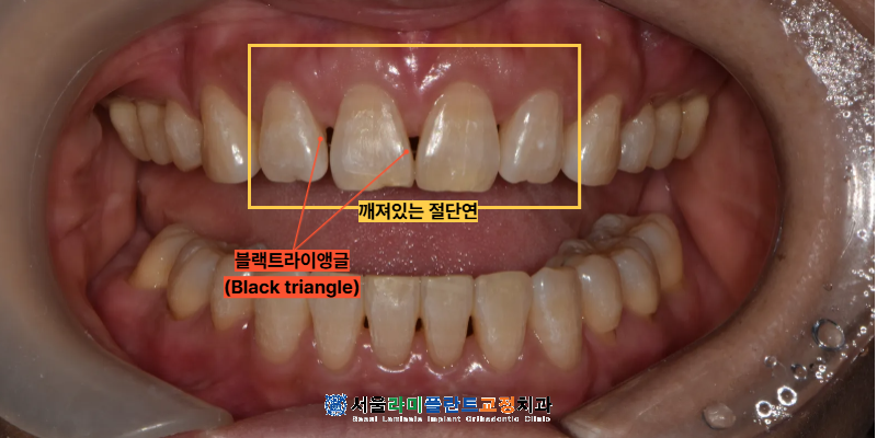 동탄라미네이트