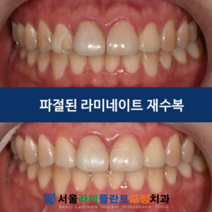 표지