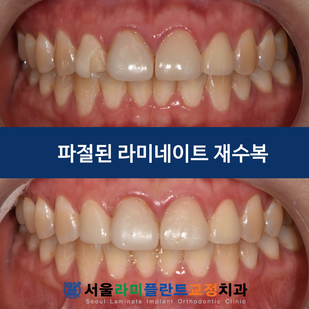 동탄역치과