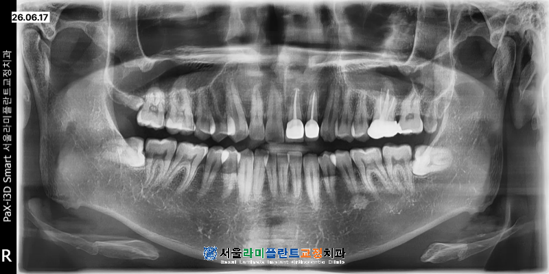 동탄치과