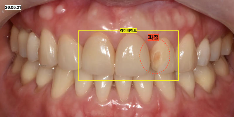 동탄역치과