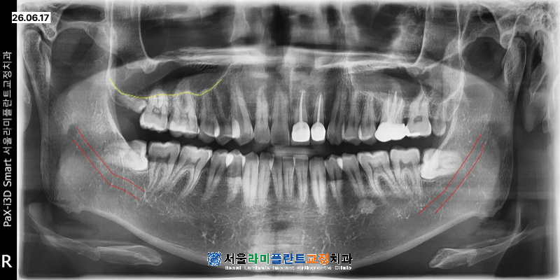 동탄치과