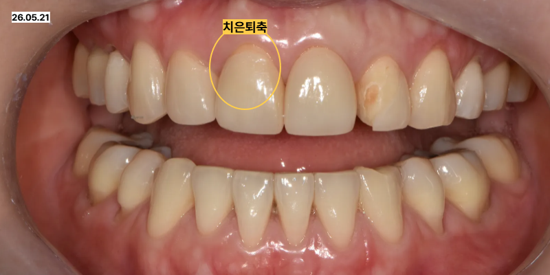 동탄역치과