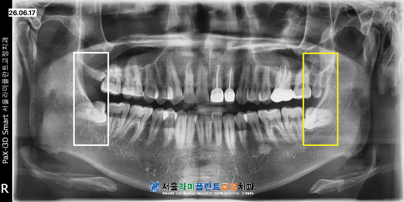 동탄치과