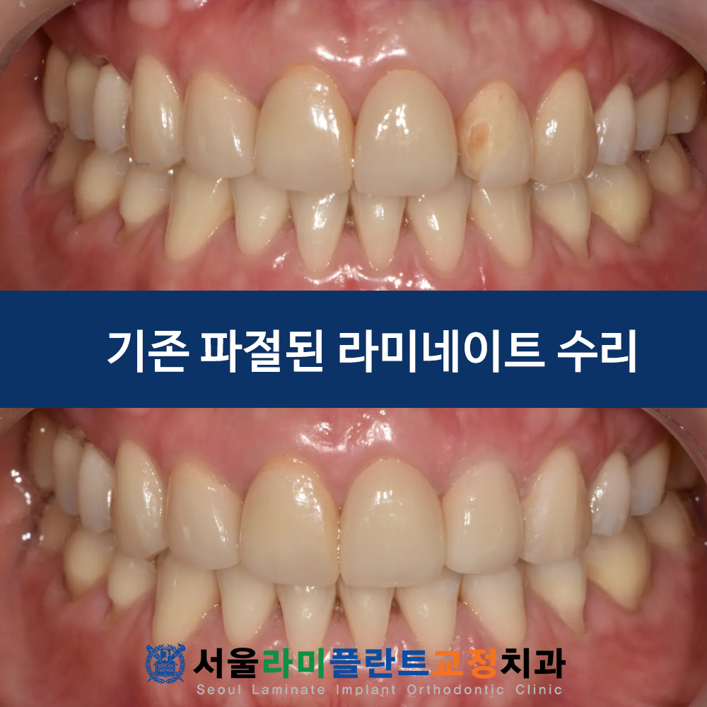 동탄역치과